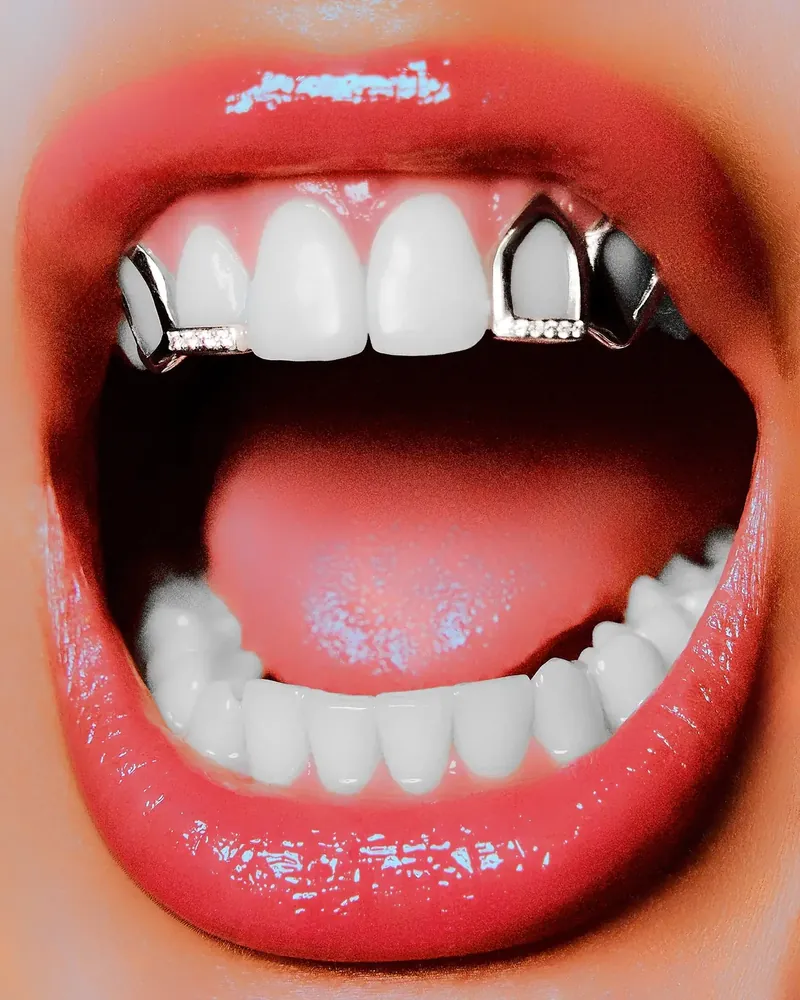 Fashion-Editorial-Detail: Mund mit Grill-Schmuck von Grill Smith in Rot, fotografiert von Mert Sahin